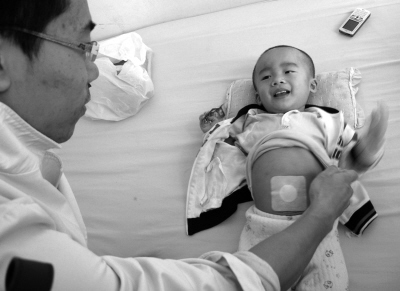 药贴治疗小儿慢性腹泻